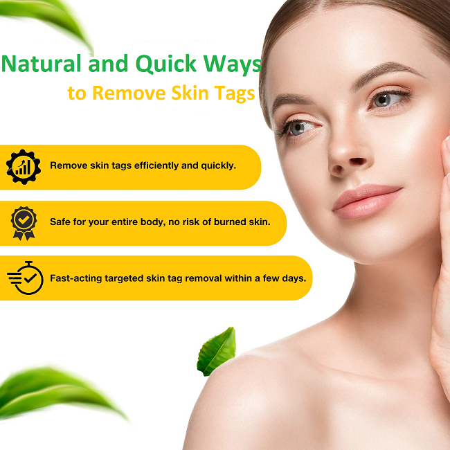 Skin Tag Home Remedies: Natural and Quick Ways to Remove Skin Tags